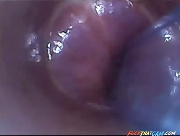 Ro89 Test tube cock endoscope POV urethral insertion ball rod Wanking