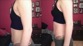 Blackcocks Boob Job Before & After (vlog) Leggings